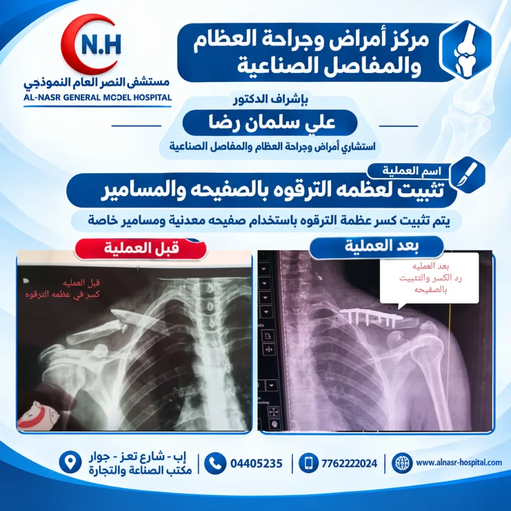 في مركز أمراض وجراحة العظام والمفاصل الصناعيه